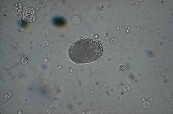 Plattenepithelien urin plattenepithelien